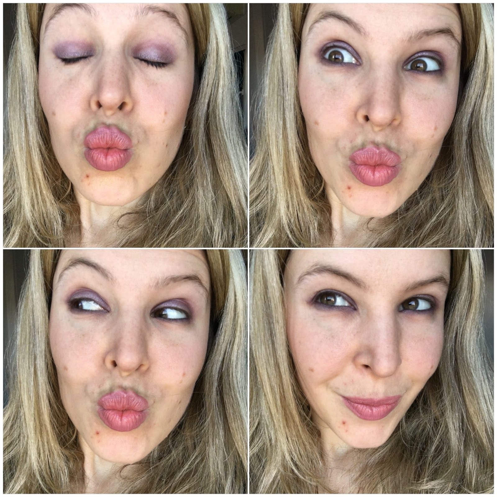 Avis Bi-Oil sur les cicatrices d'acné Avis Bi-Oil sur les cicatrices d'acné