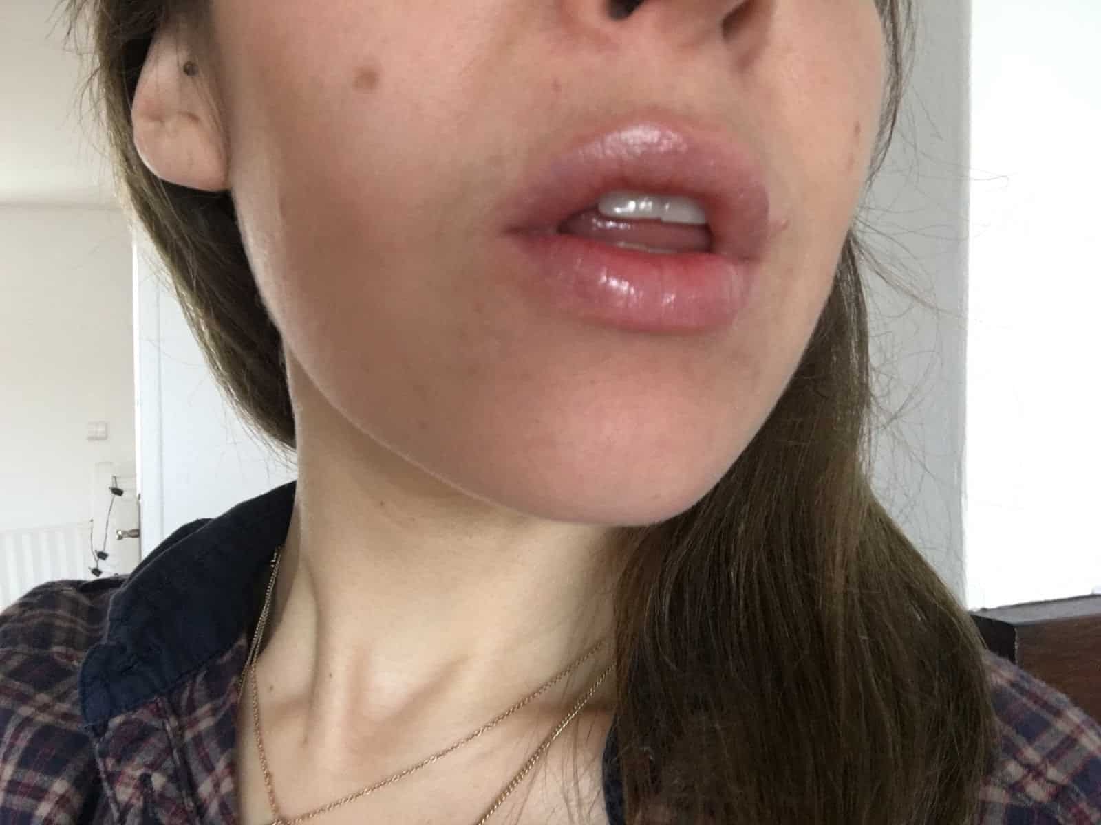 lip volume xpress Biosmose stick volume levre comme injection 