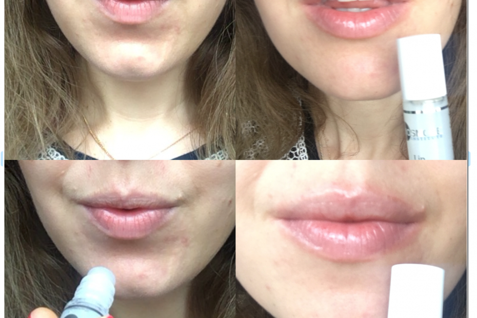 lip volume xpress Biosmose stick volume levre comme injection