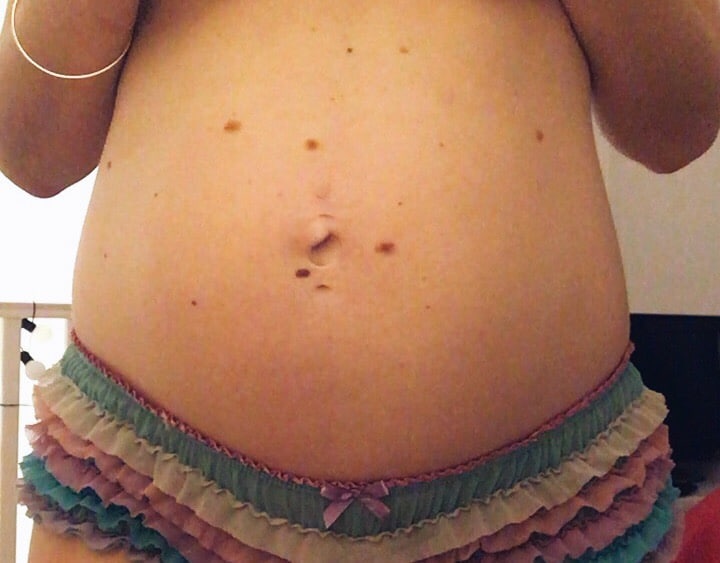 mes soins huiles anti vergetures et mes résultats aprés grossesse 