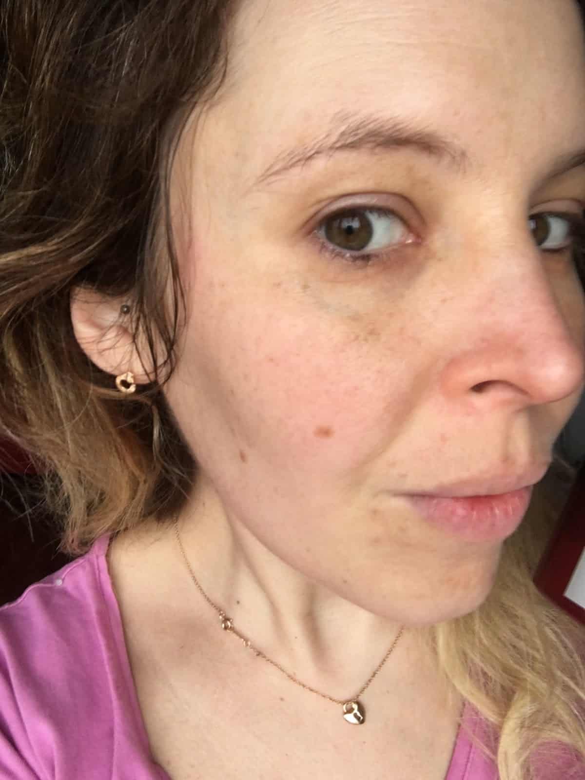 avis test disques Peeling Anti - Age Revitalif Laser 3 L'Oréal avis test disques Peeling Anti - Age Revitalif Laser 3 L'Oréal