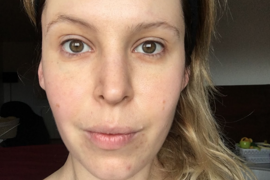 avis test disques Peeling Anti - Age Revitalif Laser 3 L'Oréal