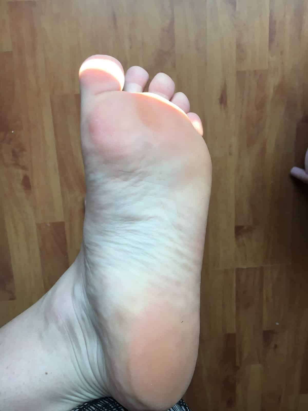 exfolier soin des pieds avec Dr Pierre Ricaud exfolier soin des pieds avec Dr Pierre Ricaud