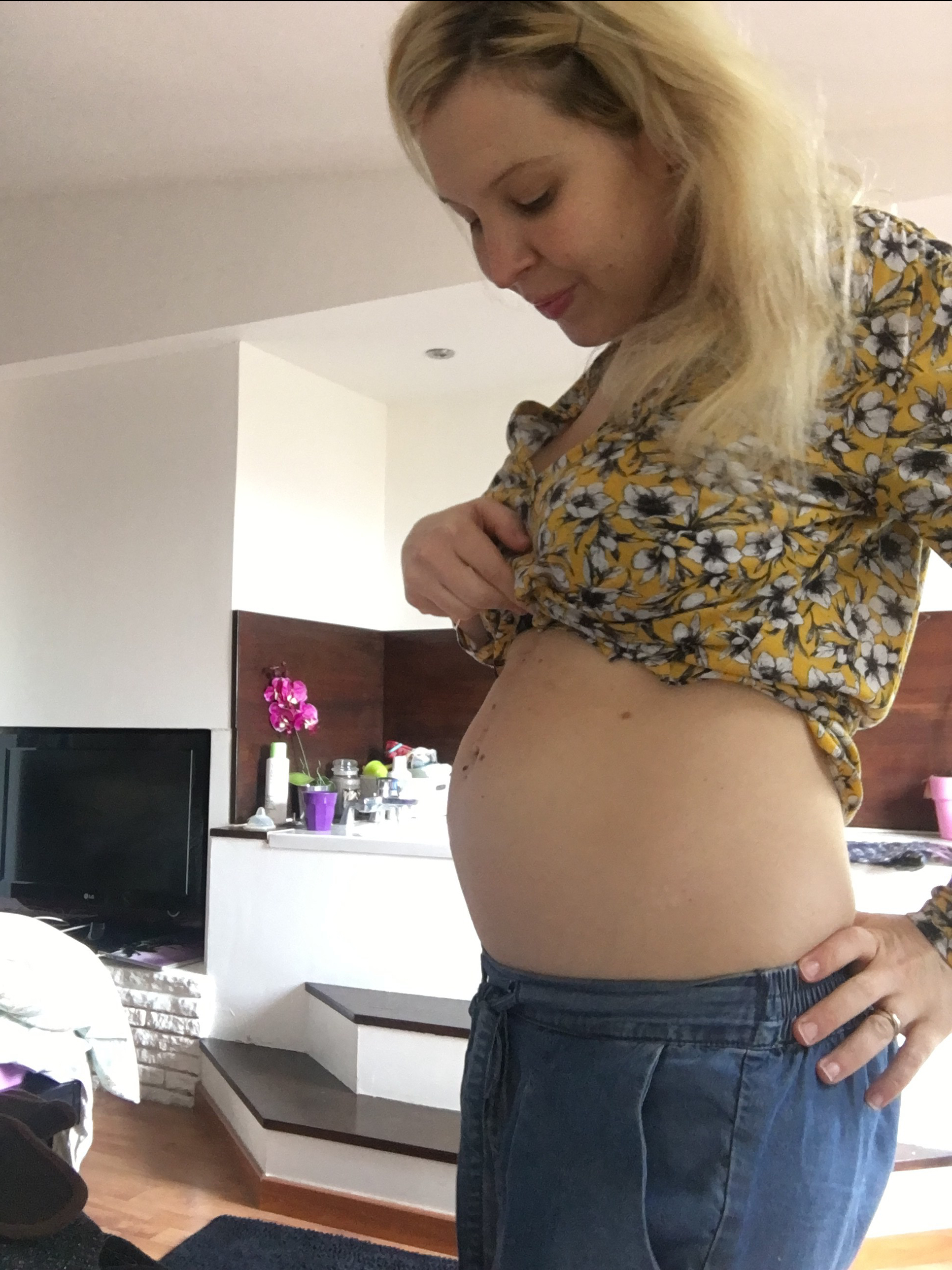 ventre aprés un accouchement d'un bébé