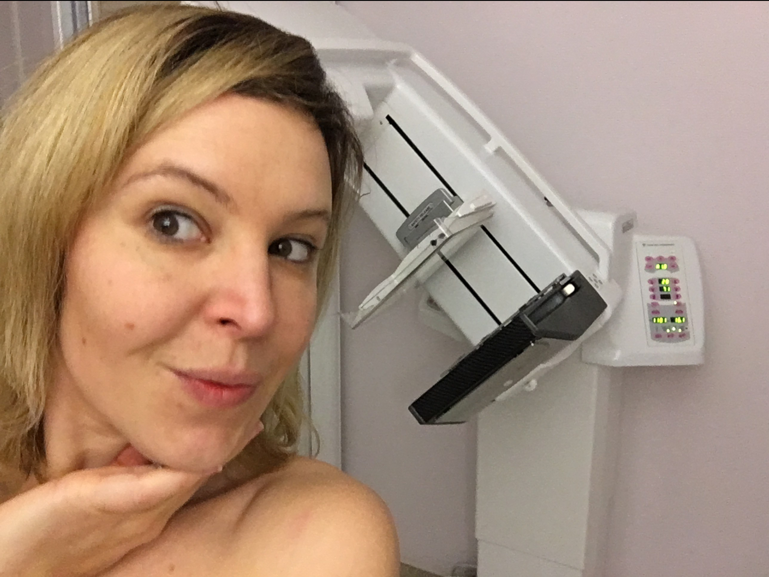 mammographie échographie des seins mon expérience