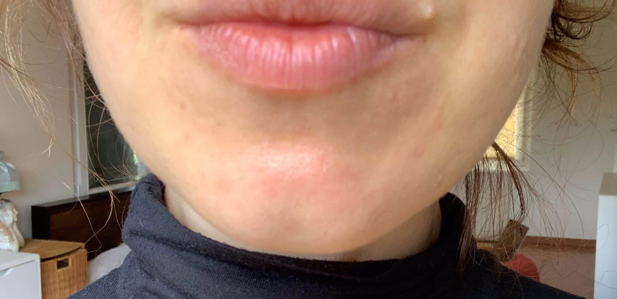 IMG_3676_Facetune_11-06-2019-15-17-27