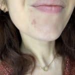 acné hormonal soins anti imperfections et anti âge avis trio-zinc Novexpert