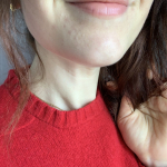 acné hormonal crème novexpert trio zinc