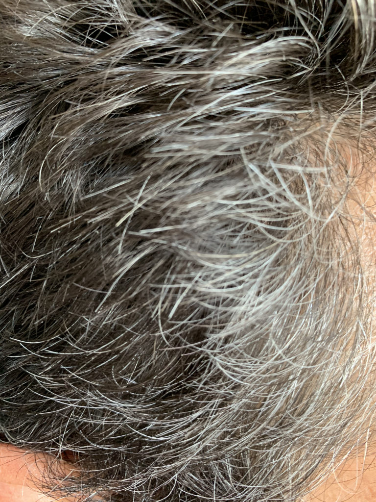 Repigmenter ses cheveux blancs L’Oréal Progress Homme