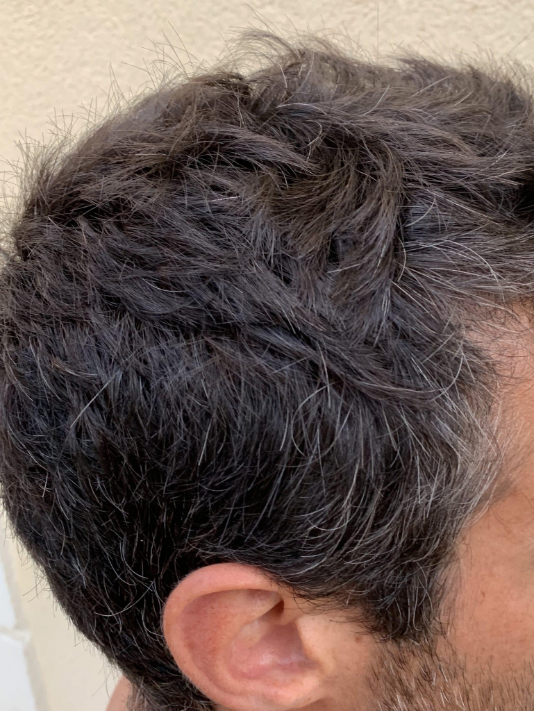 Repigmenter ses cheveux blancs L’Oréal Progress Homme