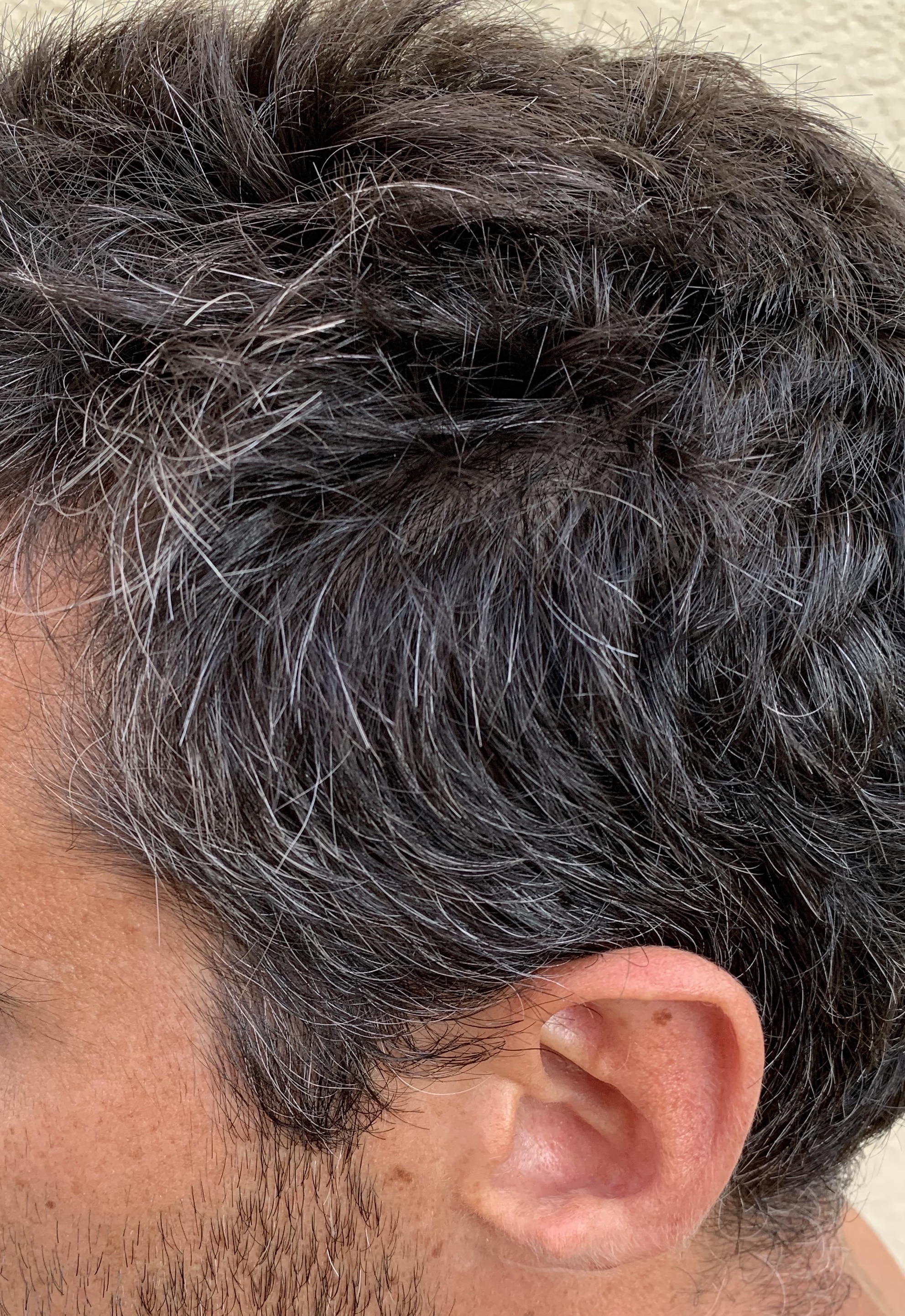 Test Progress Homme L'Oréal Comment repigmenter ses cheveux blancs — free download