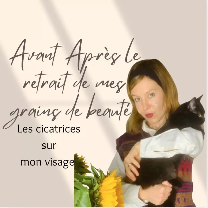 Avant Après cicatrices grains de beauté sur mon visage