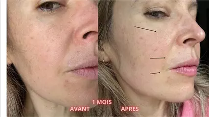 Capture d’écran 2025-11-05 à 19.24.12