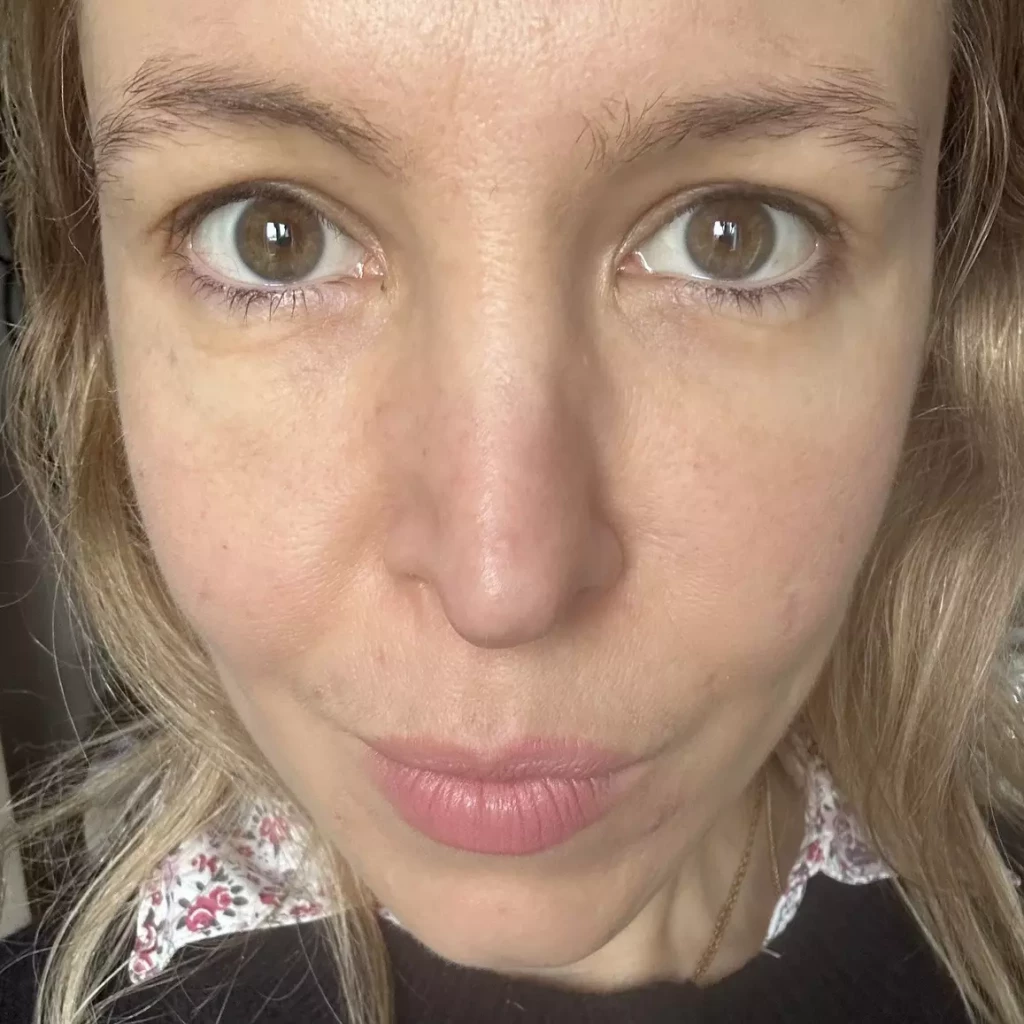 avant après revitalift laser L'Oréal Paris