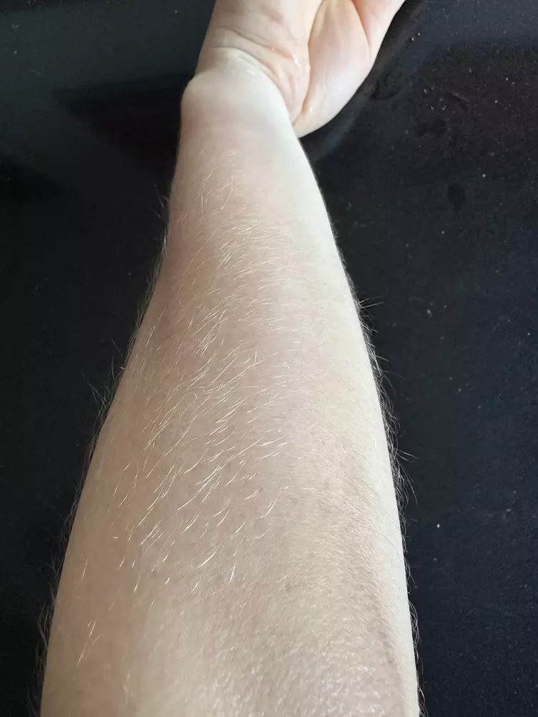 comment retirer ses poils de bras